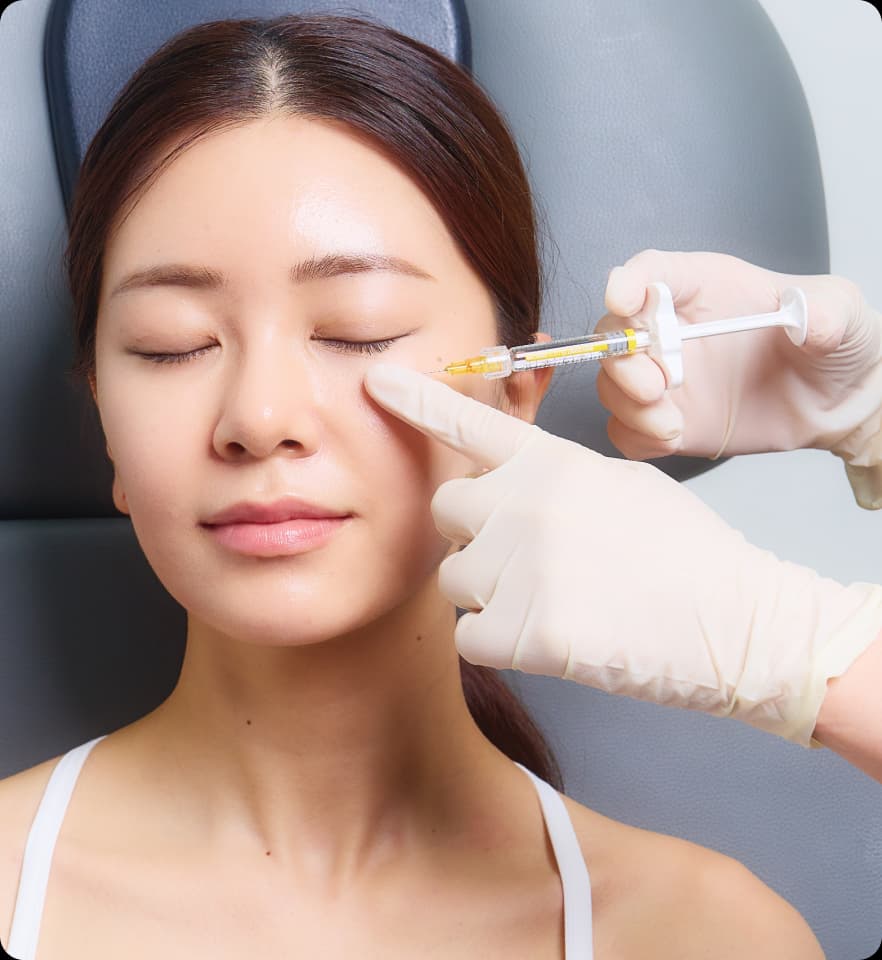 벨로테로 리바이브