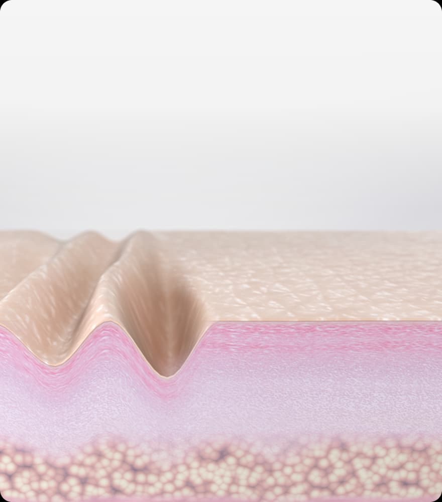 트리클 카드 배경