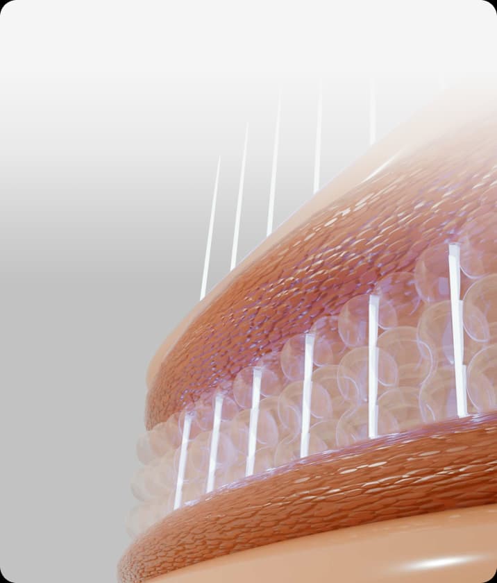 트리클 카드 배경