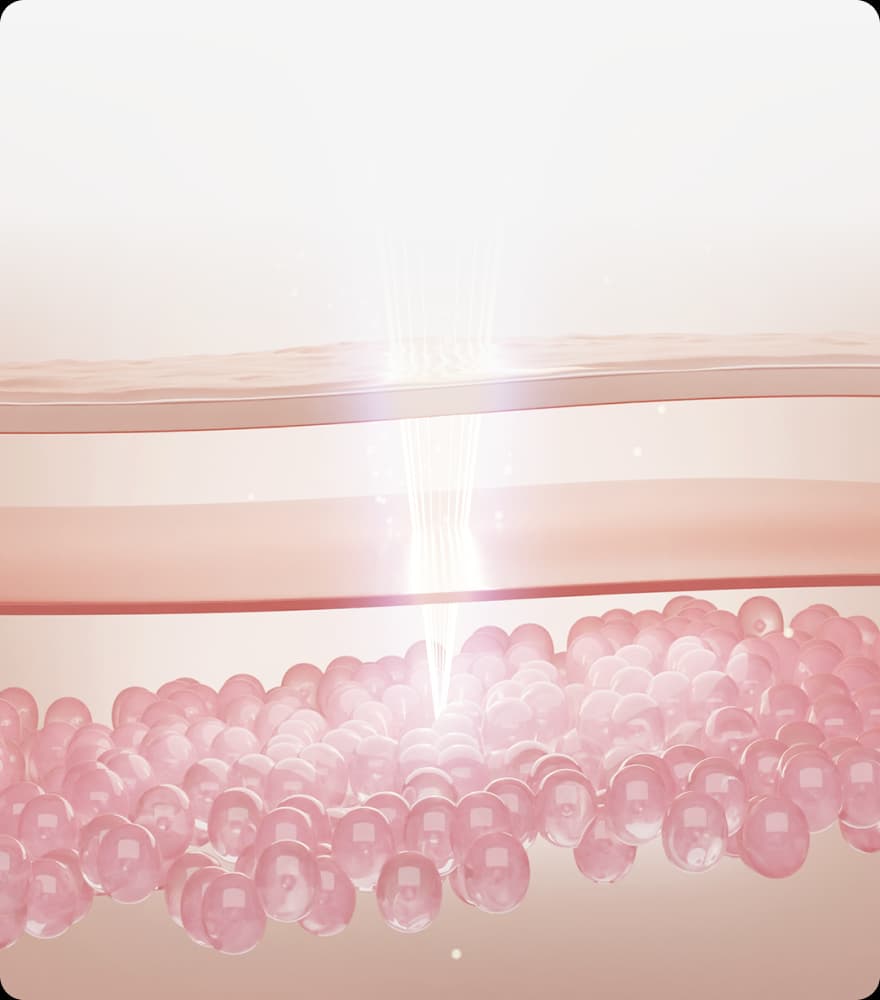 트리클 카드 배경