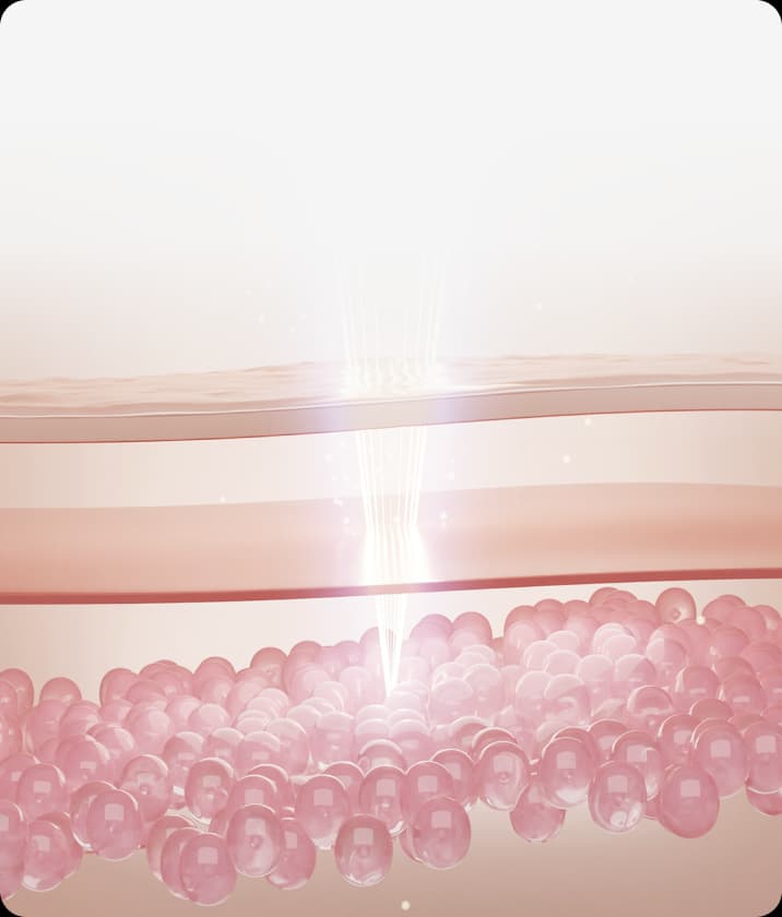 트리클 카드 배경