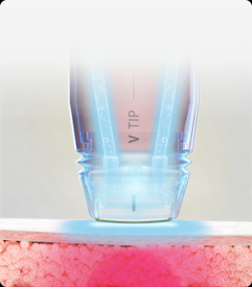 트리클 카드 배경