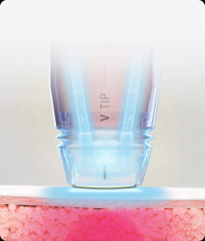 트리클 카드 배경