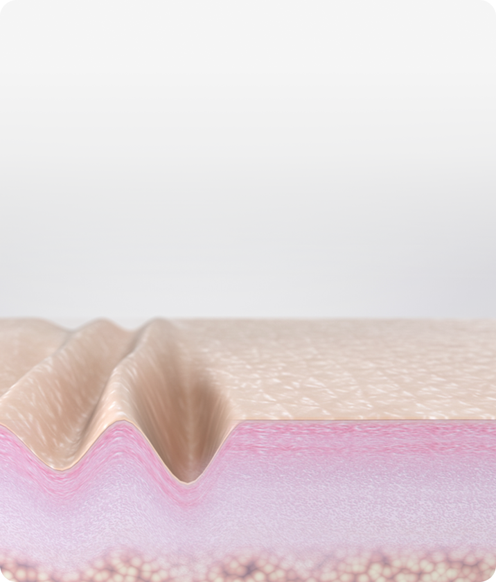 트리클 카드 배경