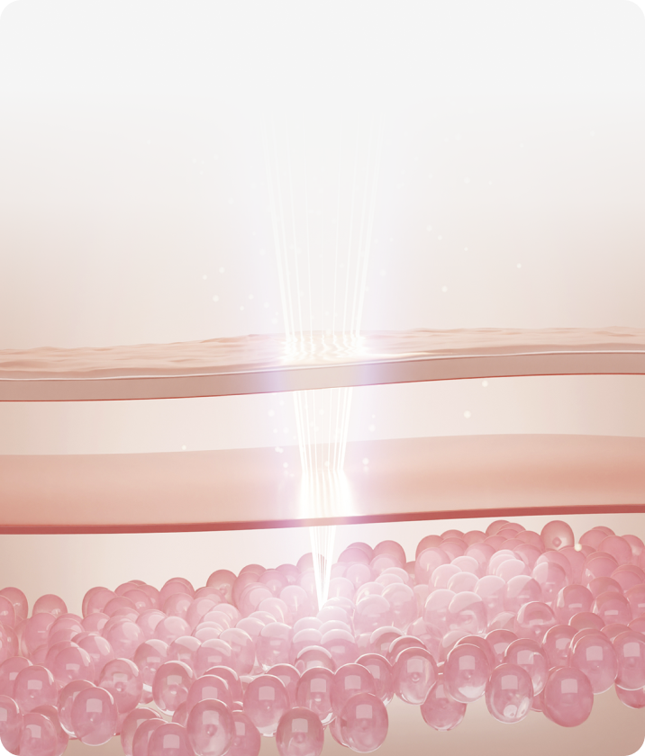 트리클 카드 배경