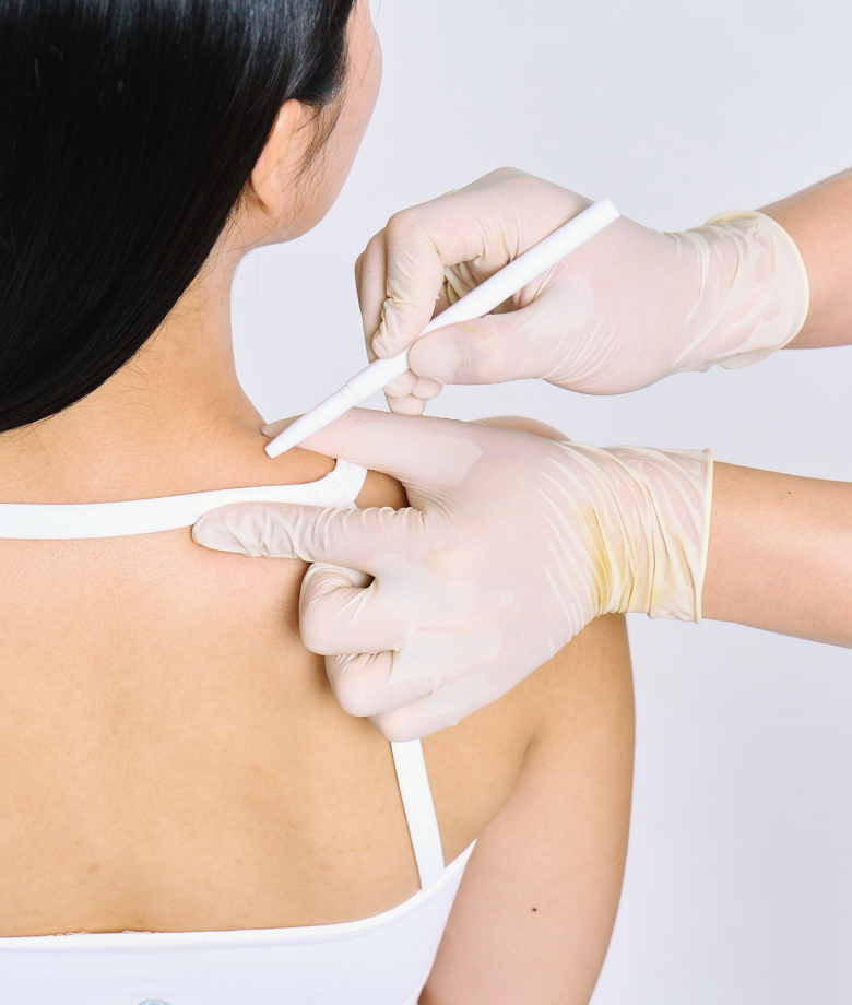 맞춤 시술 이미지 1