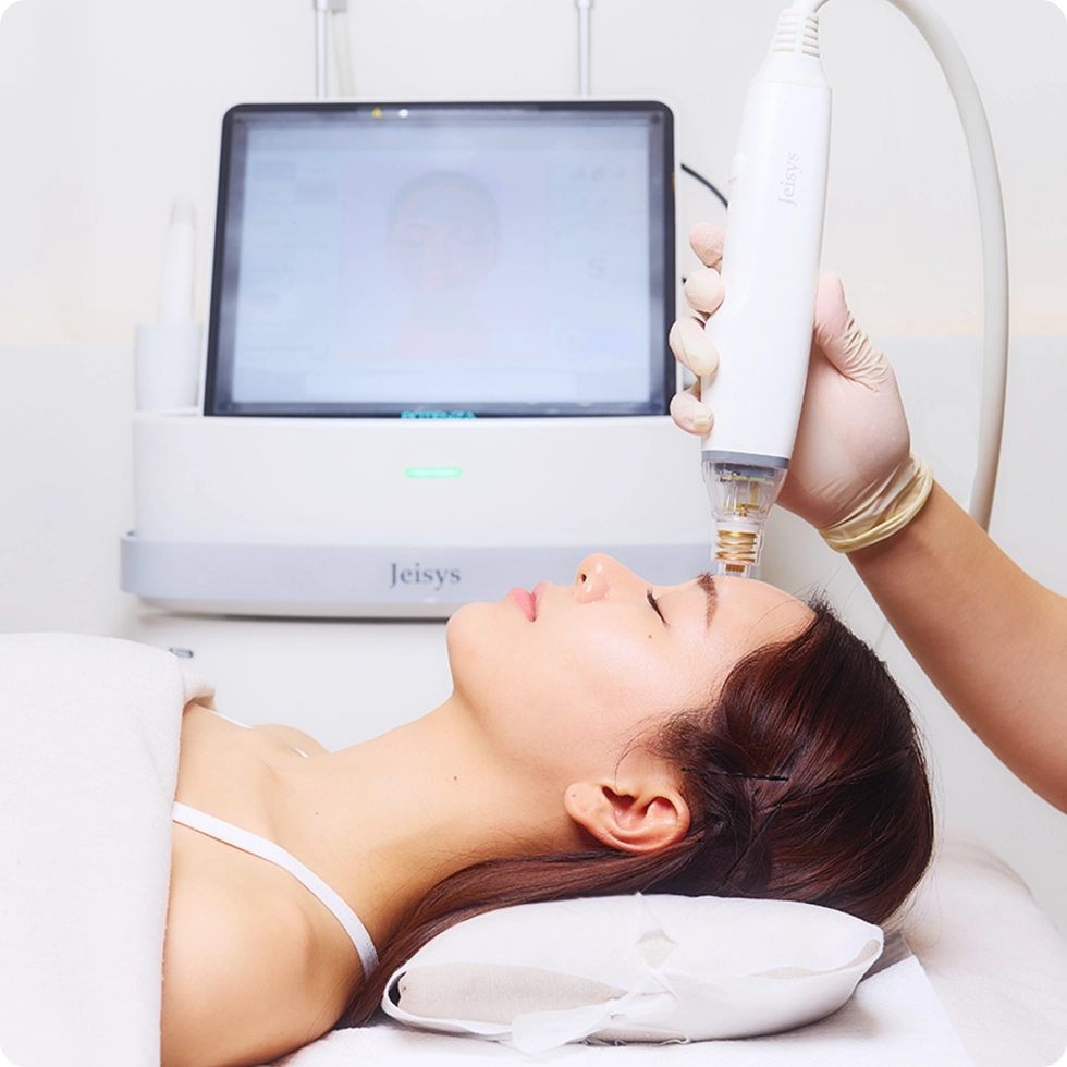 Optimal Injector Recommendation & Treatment