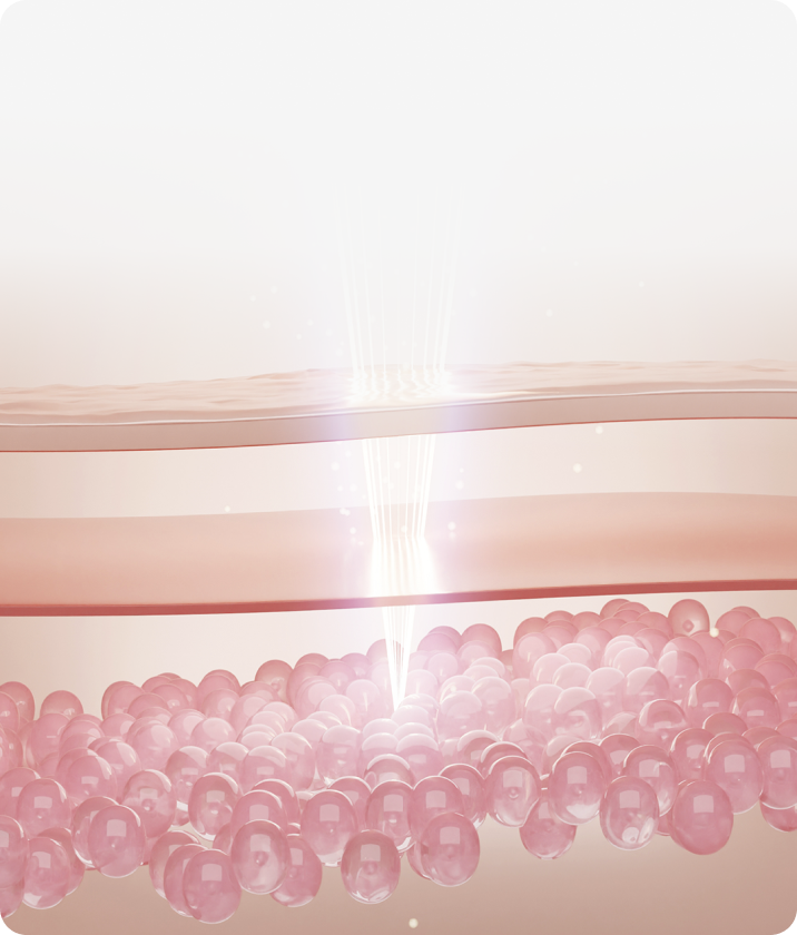 트리클 카드 배경