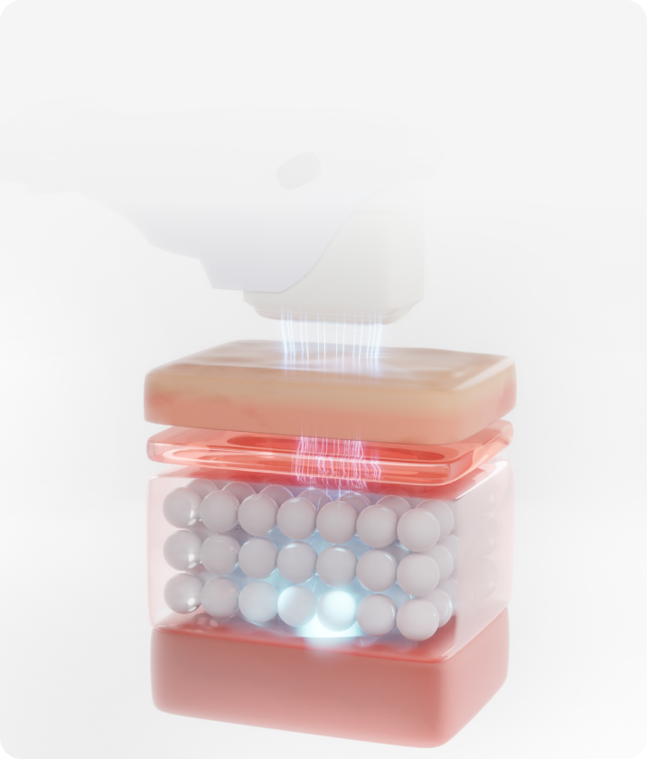 트리클 카드 배경