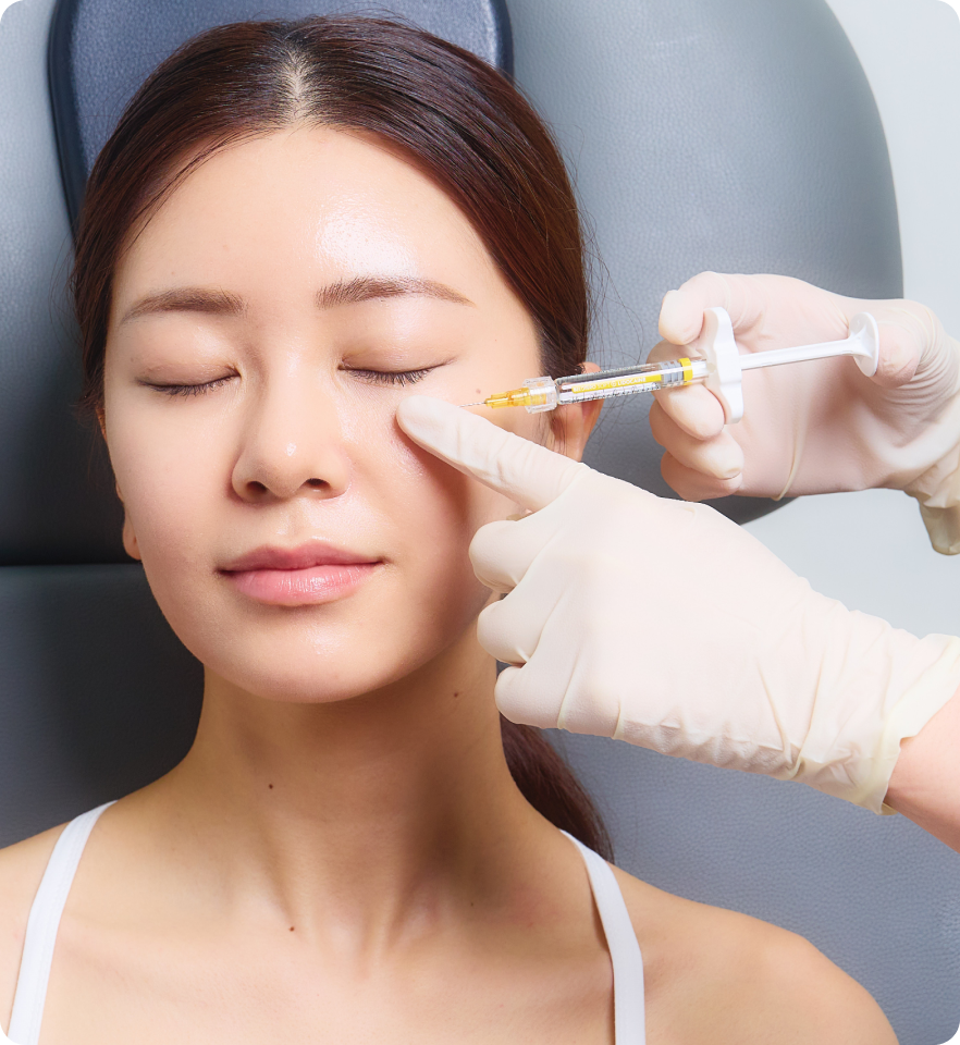 벨로테로 리바이브